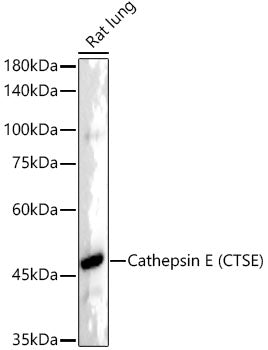 Cathepsin E (CTSE) Rabbit mAb