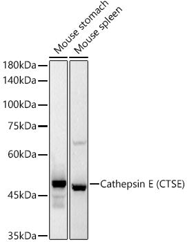Cathepsin E (CTSE) Rabbit mAb