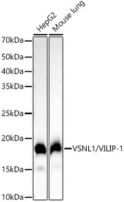 VSNL1/VILIP-1 Rabbit mAb