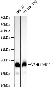 VSNL1/VILIP-1 Rabbit mAb
