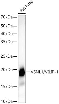 VSNL1/VILIP-1 Rabbit mAb