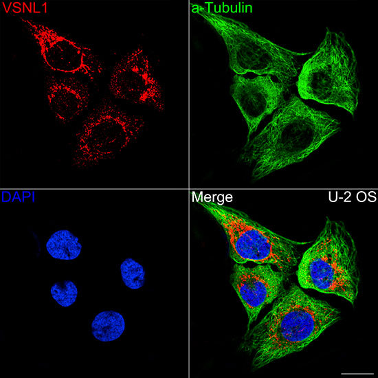 VSNL1/VILIP-1 Rabbit mAb