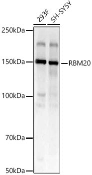 RBM20 Rabbit pAb