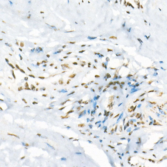 ATR Rabbit mAb