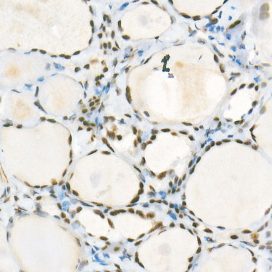 ATR Rabbit mAb