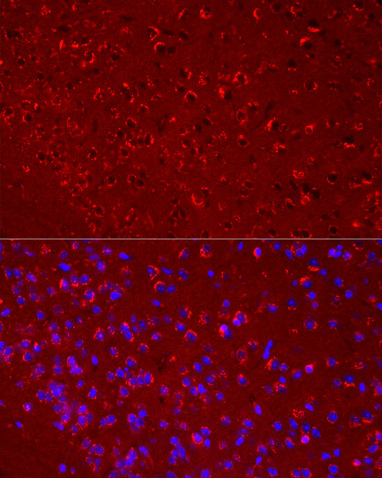 DKK3 Rabbit mAb