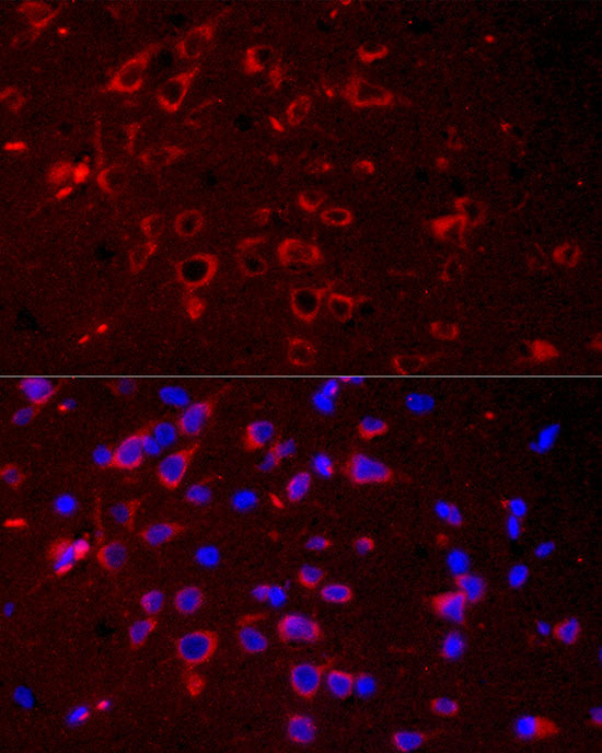 DKK3 Rabbit mAb