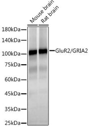 GluR2/GRIA2 Rabbit mAb