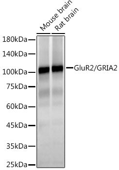 GluR2/GRIA2 Rabbit mAb