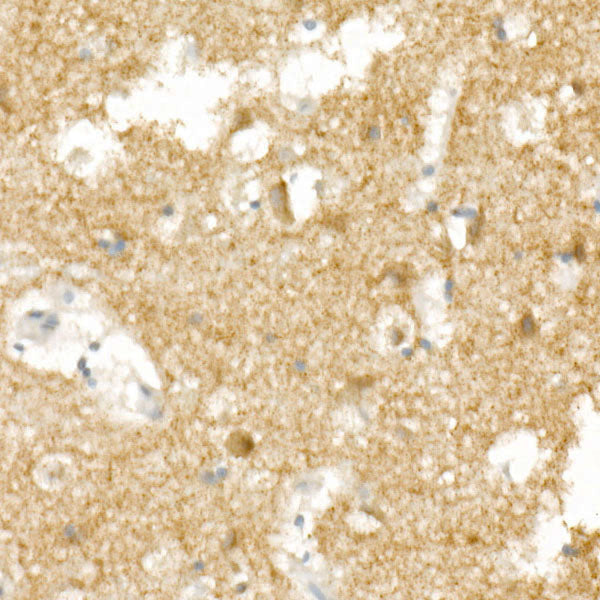 GluR2/GRIA2 Rabbit mAb