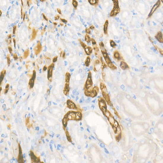 PHGDH Rabbit mAb