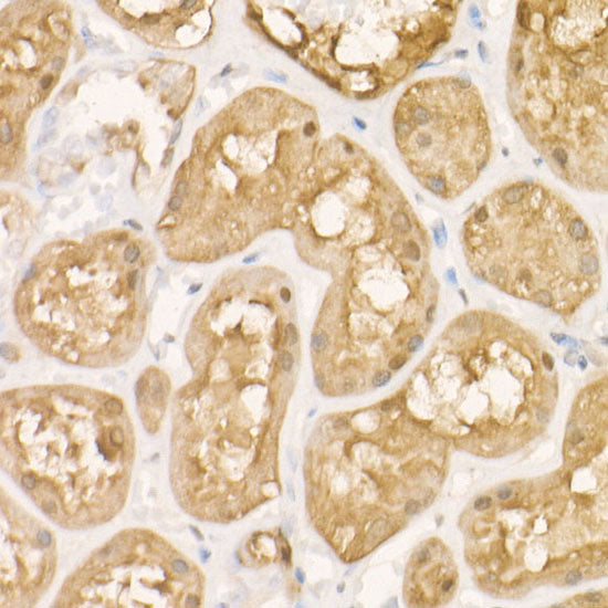 PHGDH Rabbit mAb
