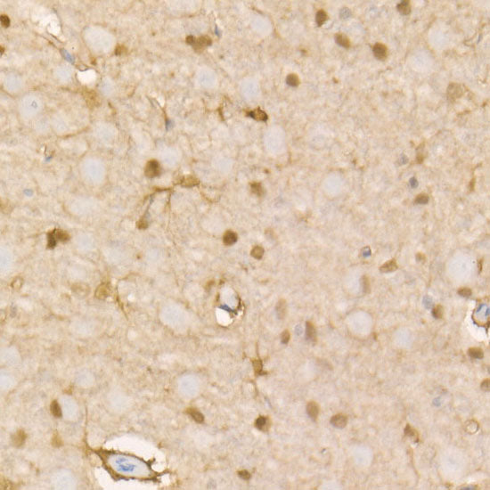 PHGDH Rabbit mAb