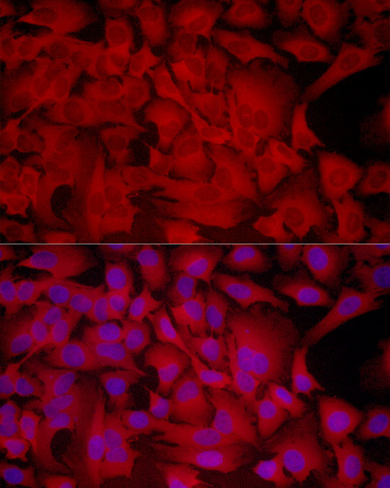 PHGDH Rabbit mAb