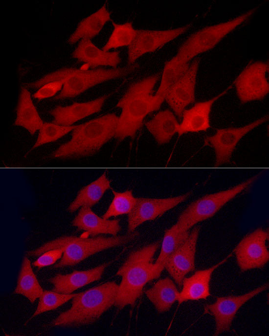 PHGDH Rabbit mAb