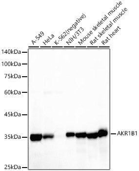 AKR1B1 Rabbit mAb