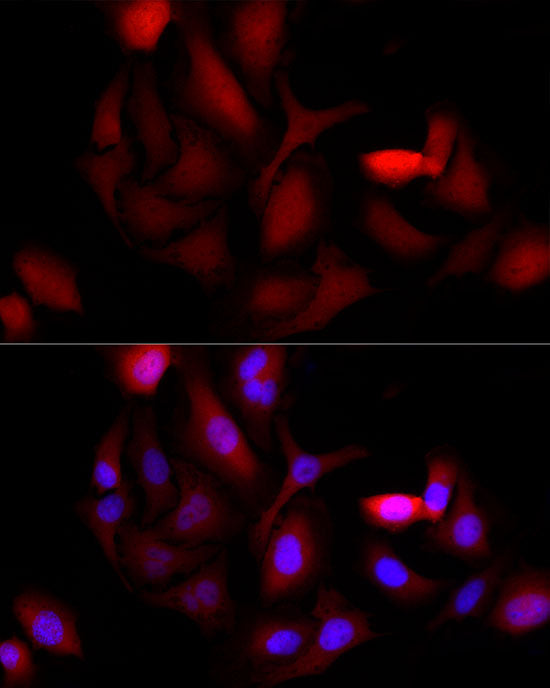 AKR1B1 Rabbit mAb