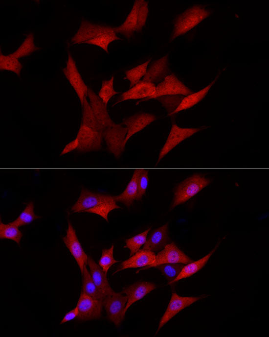 AKR1B1 Rabbit mAb