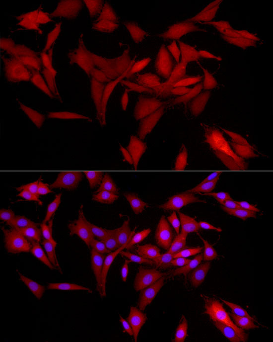 AKR1B1 Rabbit mAb