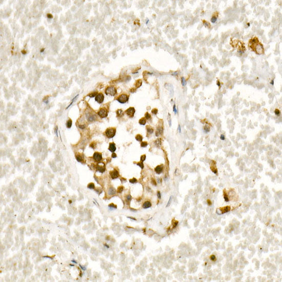 [KO Validated] Smad3 Rabbit mAb