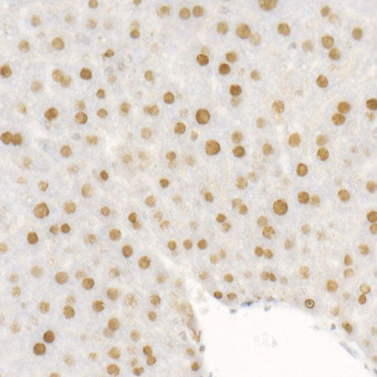 DNA Ligase III/LIG3 Rabbit mAb