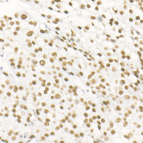 DNA Ligase III/LIG3 Rabbit mAb