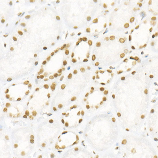 DNA Ligase III/LIG3 Rabbit mAb
