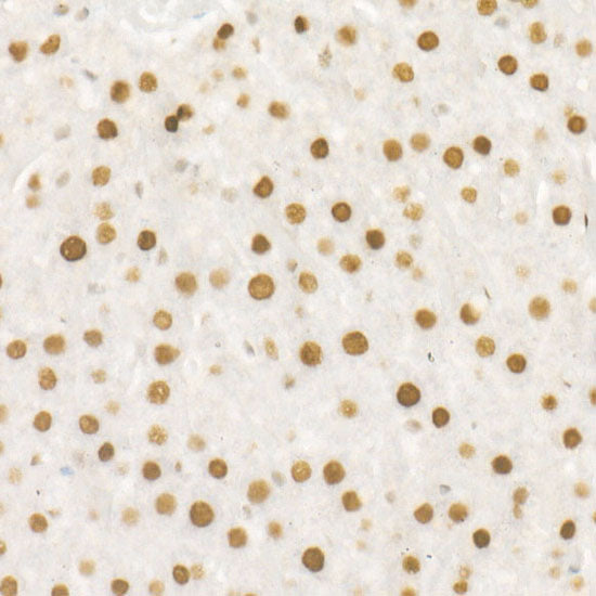 DNA Ligase III/LIG3 Rabbit mAb
