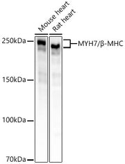 MYH7/β-MHC Rabbit mAb