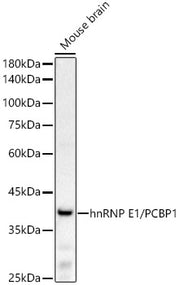 hnRNP E1/PCBP1 Rabbit mAb