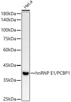 hnRNP E1/PCBP1 Rabbit mAb