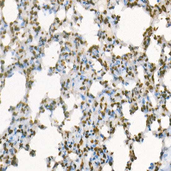 Asymmetric DiMethyl-Histone H3-R8 Rabbit mAb