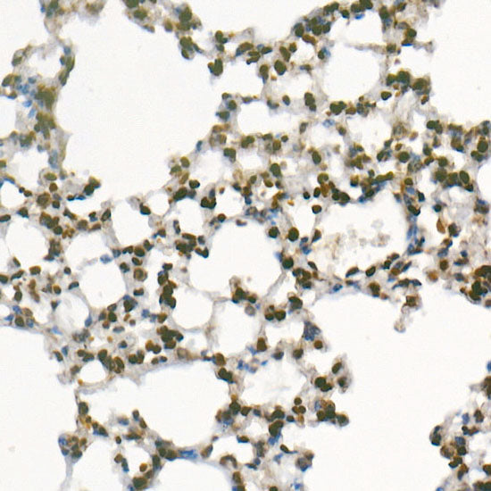 Asymmetric DiMethyl-Histone H3-R8 Rabbit mAb