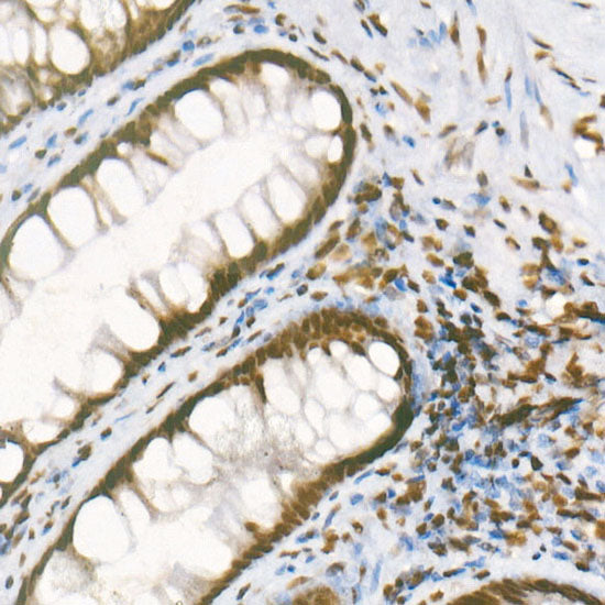 Asymmetric DiMethyl-Histone H3-R8 Rabbit mAb