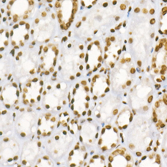 Asymmetric DiMethyl-Histone H3-R8 Rabbit mAb