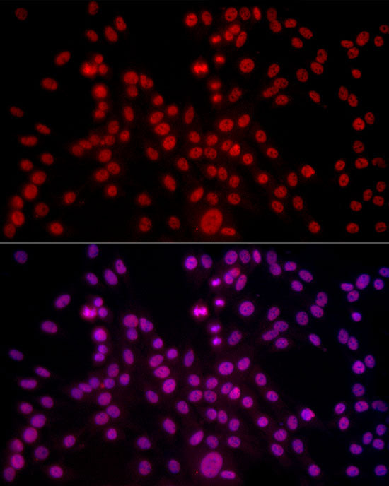 TriMethyl-Histone H3-K4 Rabbit mAb
