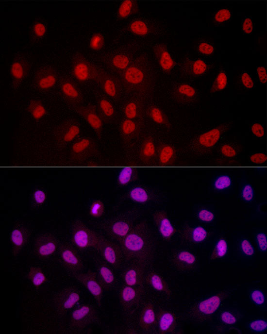 TriMethyl-Histone H3-K4 Rabbit mAb