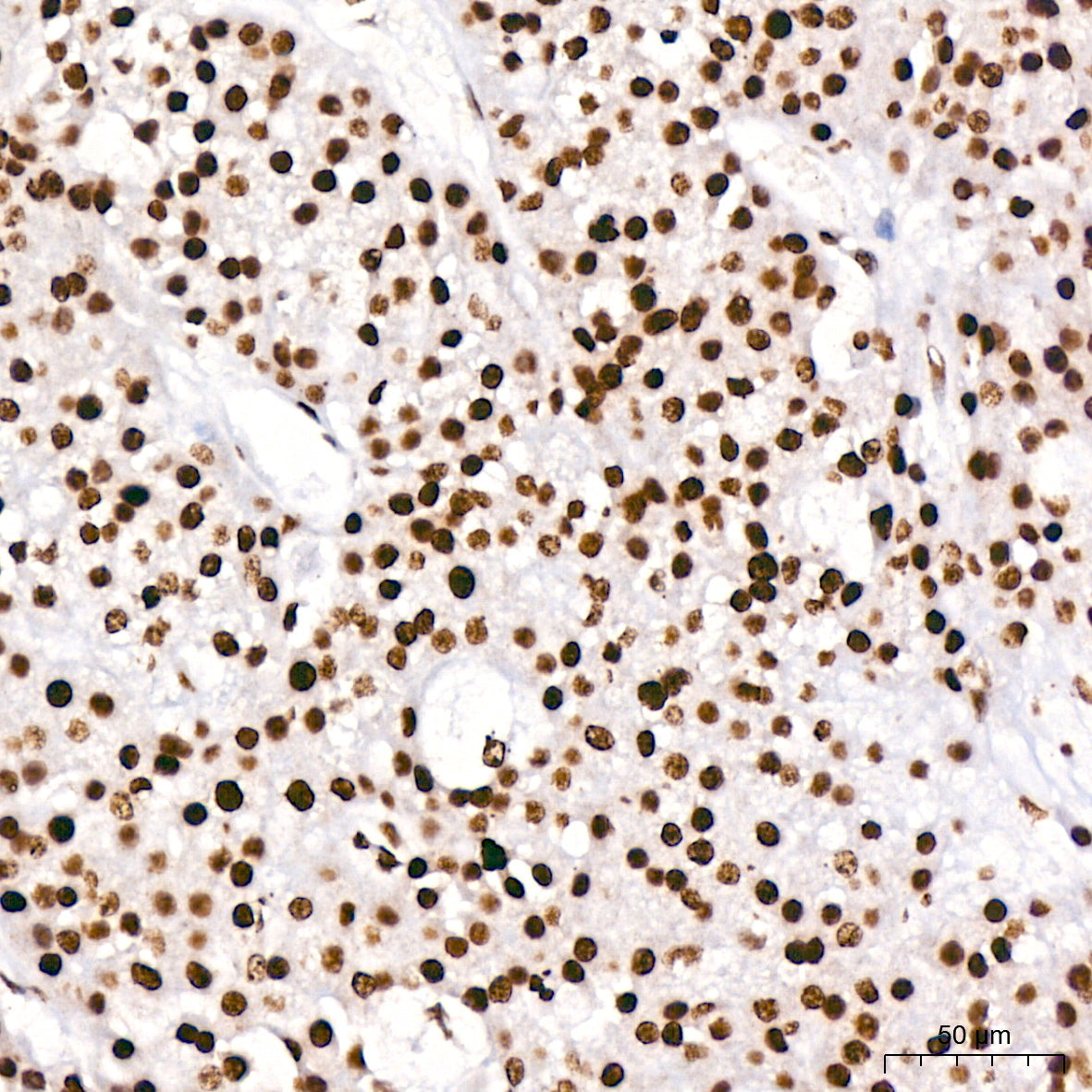 TriMethyl-Histone H3-K4 Rabbit mAb