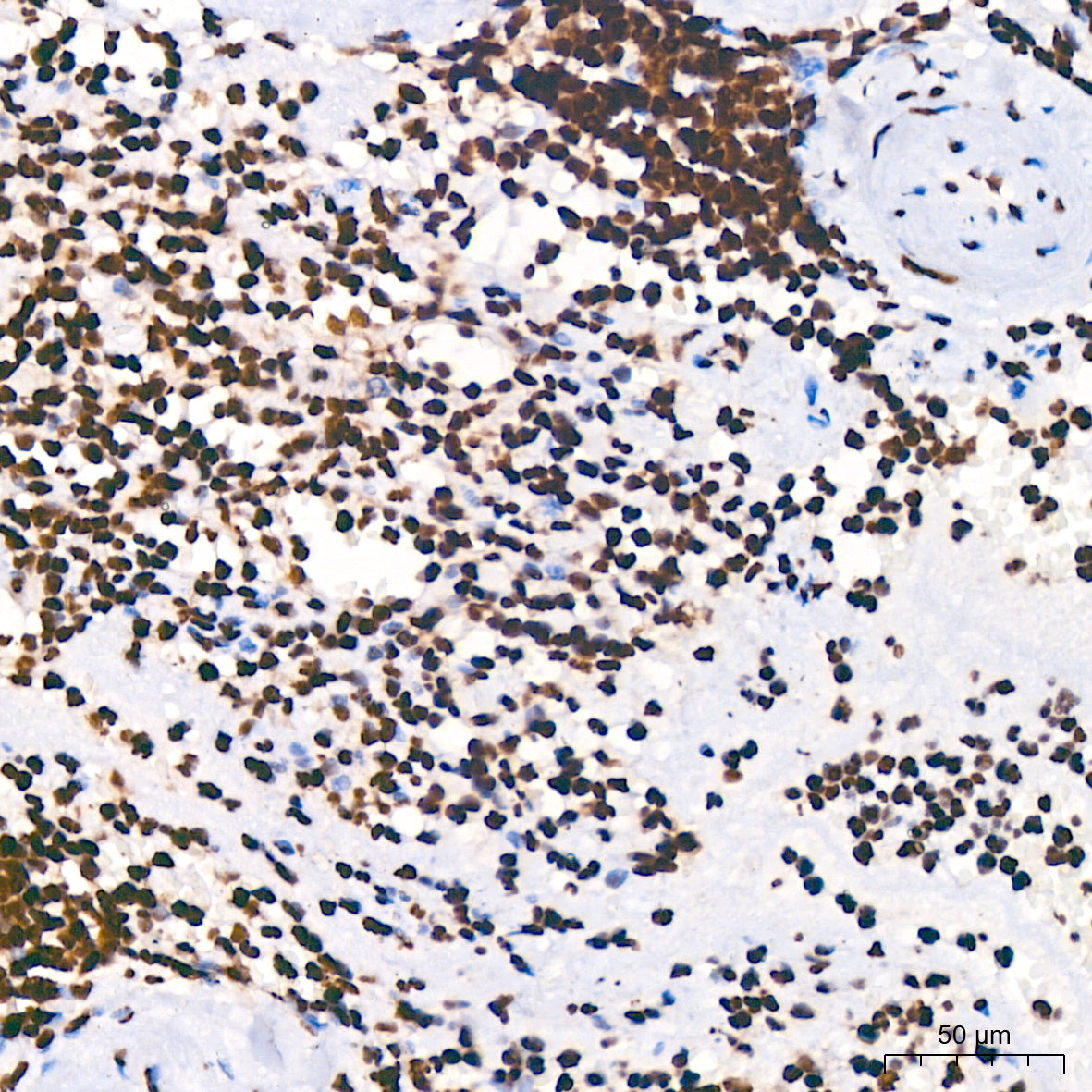 TriMethyl-Histone H3-K4 Rabbit mAb