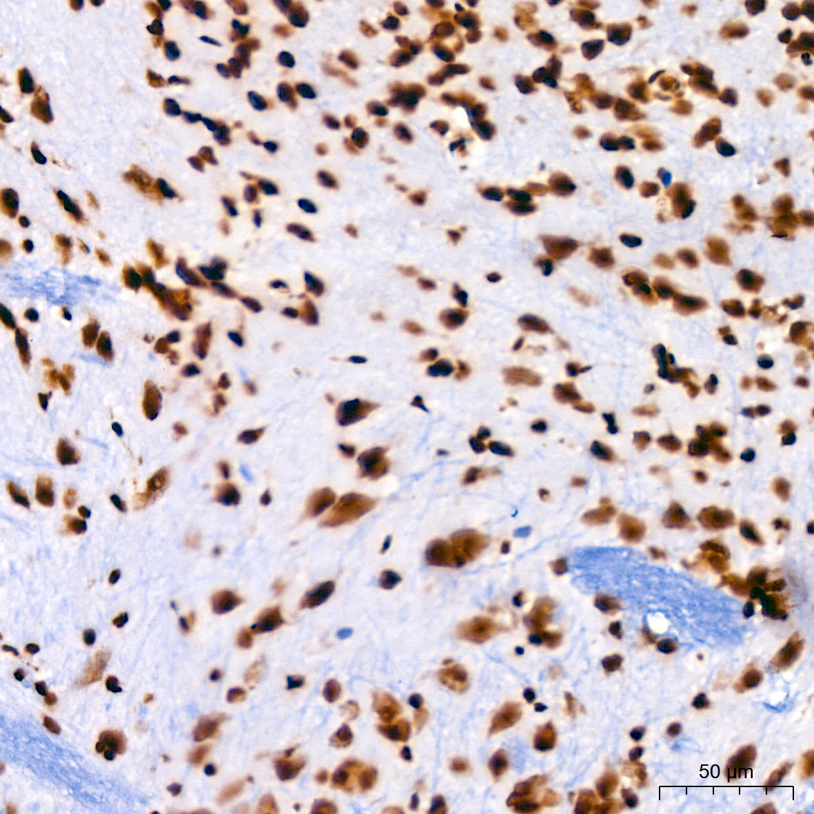 TriMethyl-Histone H3-K4 Rabbit mAb