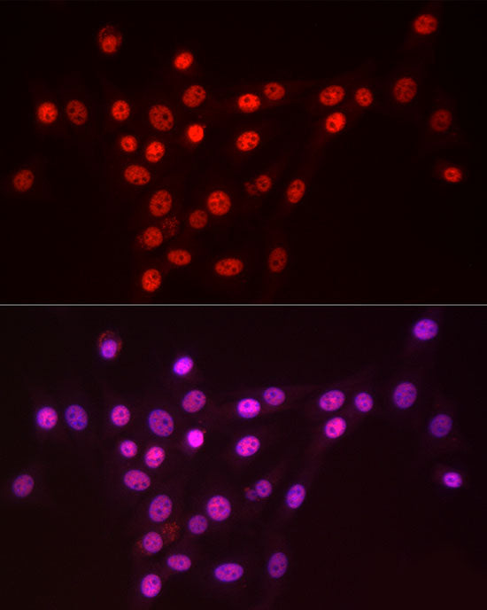 TriMethyl-Histone H3-K4 Rabbit mAb