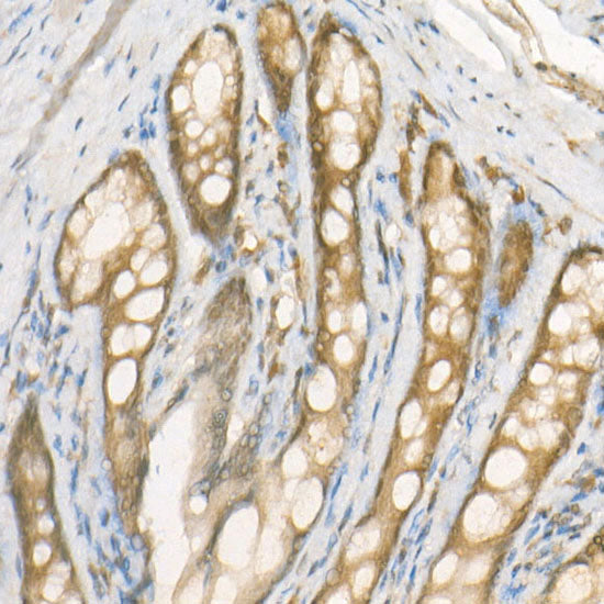 NADPH oxidase 4 (NOX4) Rabbit mAb