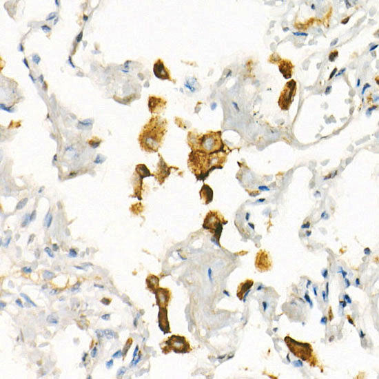 [KO Validated] CD71/Transferrin Receptor Rabbit mAb