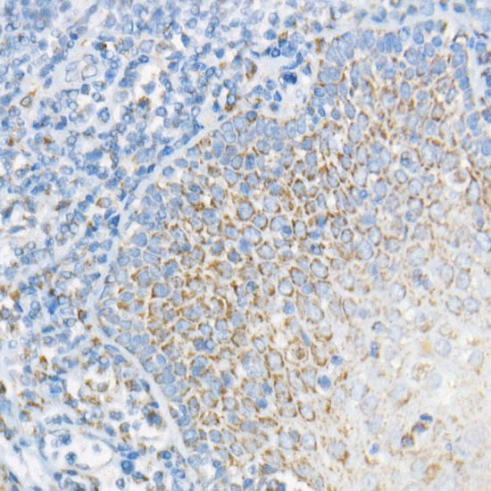 NDUFS3 Rabbit mAb