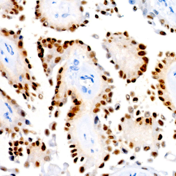 PAX8 Rabbit mAb