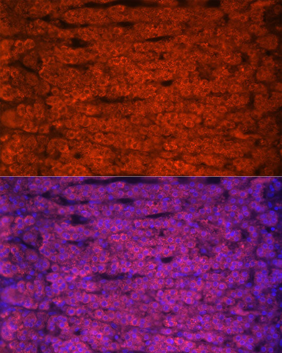 StAR Rabbit mAb