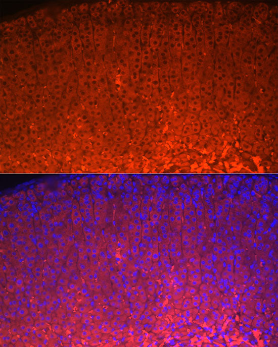 StAR Rabbit mAb