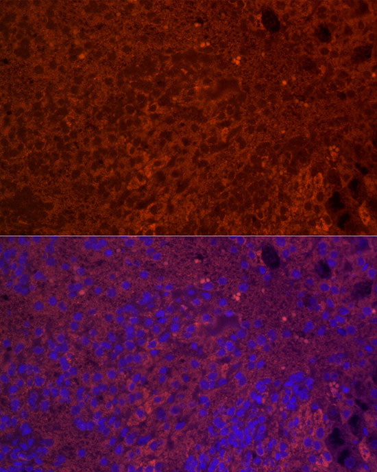 StAR Rabbit mAb