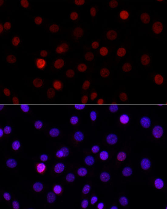 MonoMethyl-Histone H3-K27 Rabbit mAb