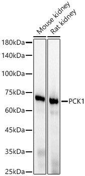 PCK1 Rabbit mAb